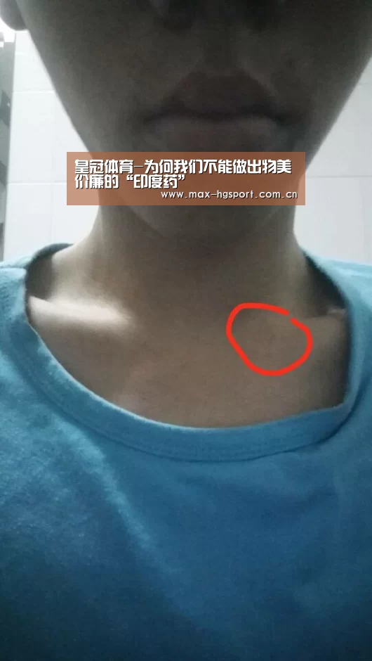 皇冠体育-为何我们不能做出物美价廉的“印度药”(图3) 皇冠娱乐